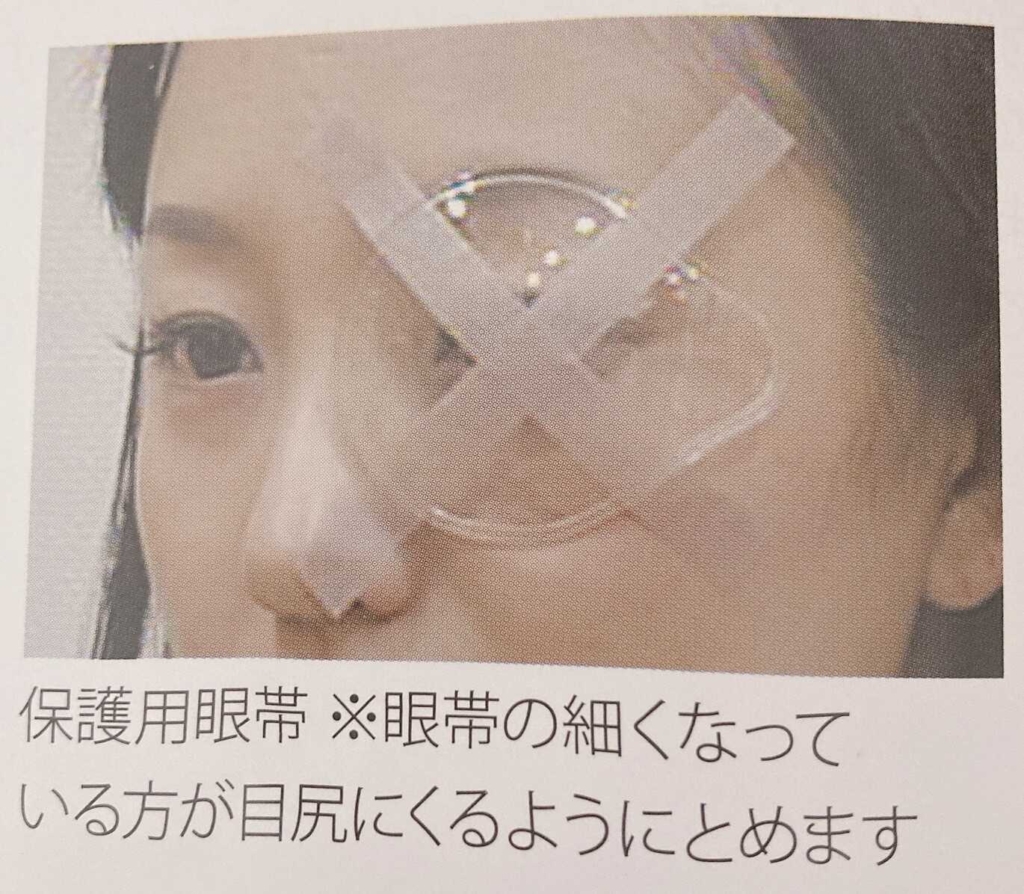 レーシック手術後につける眼帯の着用写真